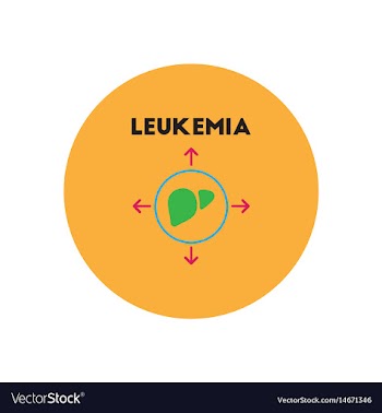 Icon on circle various symptoms of leukem vector image