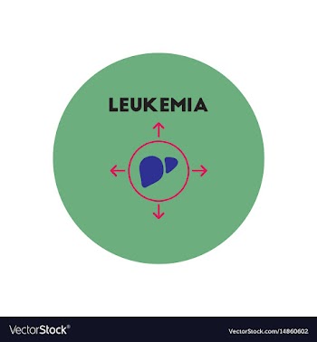 Icon on circle various symptoms of leukem vector image