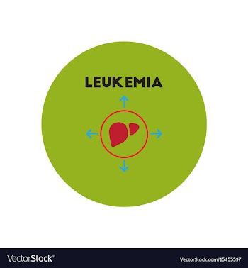 Icon on circle various symptoms of leukem vector image