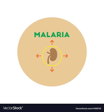 Icon on circle various symptoms of malar vector image