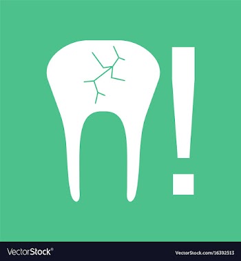 Icon tooth fracture vector image