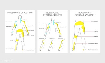 Illustration of body pain points | Free stock vector - 395074