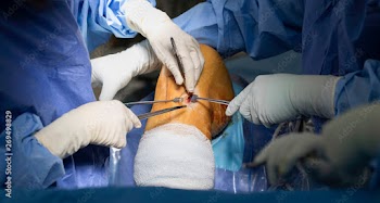 Knee Surgery