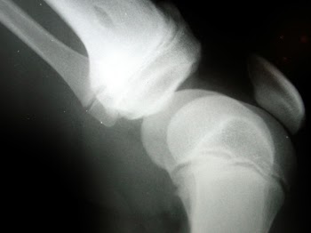 kneesCN9694.jpg