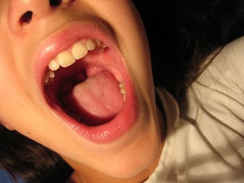 Krol_mouth01_xa.jpg