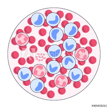 Leukemia examination concept