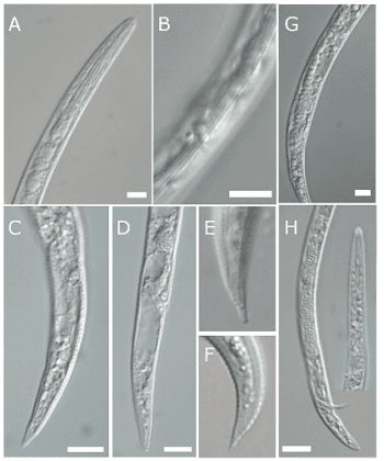 Light micrographs of Paratylenchus (Gracilacus) straeleni, Turkey ...