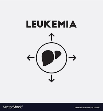 Liver disease symptoms of malaria on the vector image