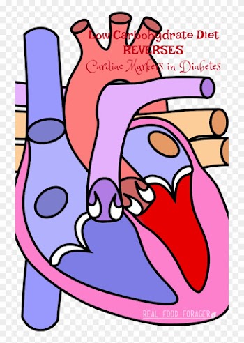 Low Carbohydrate Diet Reverses Cardiac Markers In Diabetes - Diagram Of The Heart