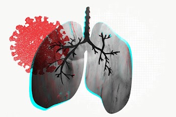 Lungs infected with coronavirus background | Free  transparent png - 2316960