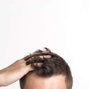 Man having hair fall problem standing against white background Free Photo