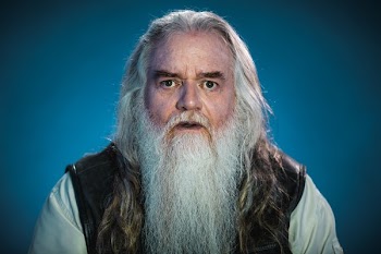 Man With White Beard Stunned