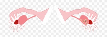 Medical Treatment Pcos - Polycystic Ovary Syndrome