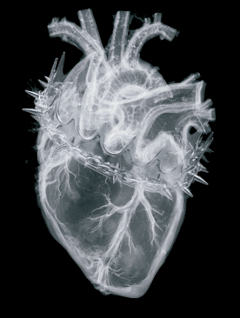 Monochrome X-Ray of a Human Heart with Punk Crown