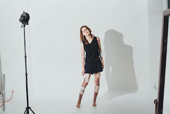 表皮水泡症の女性のポートレート