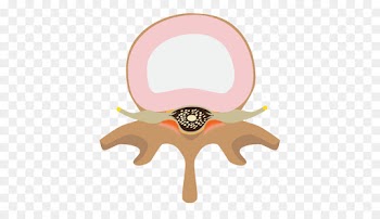 Neck Pain, Vertebral Column, Cervical Vertebrae, Pink, Plant PNG