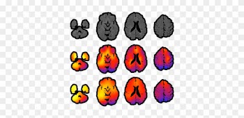 New O - Medical Imaging