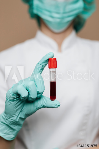 Nurse holding a blood test tube