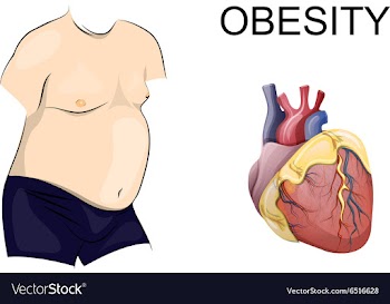 Obesity body and heart vector image