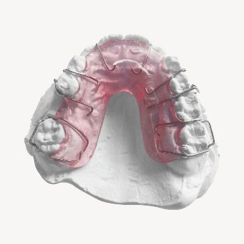Orthodontic retainer collage element, isolated | Free PSD - rawpixel