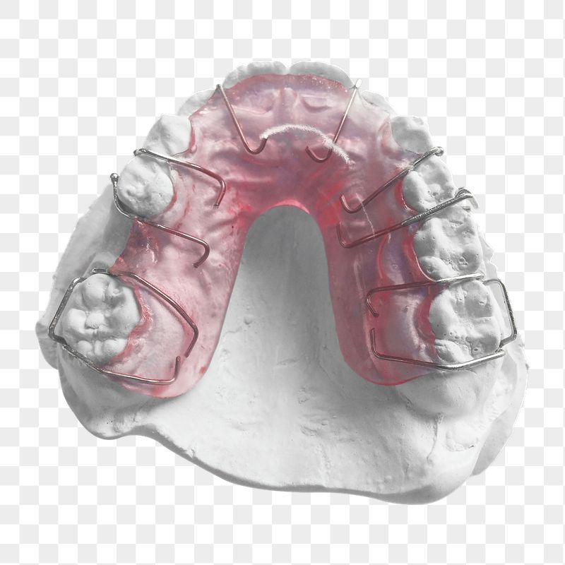 Orthodontic retainer png sticker, transparent | Free PNG - rawpixel