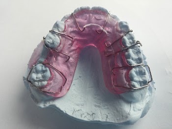 Orthodontic Retainers. Free public domain | Free Photo - rawpixel