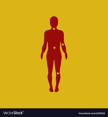 Osteoarthritis points on body vector image