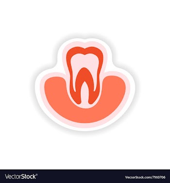 Paper sticker on white background tooth in gums vector image