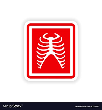 Paper sticker on white background X-rays of ribs vector image