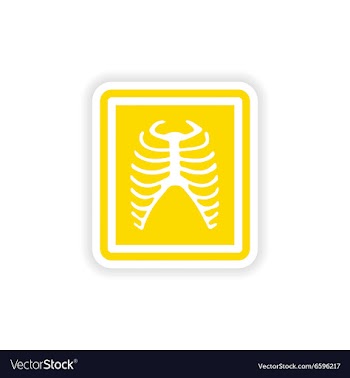 Paper sticker on white background X-rays of ribs vector image