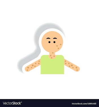 Paper sticker various symptoms of AIDS on vector image