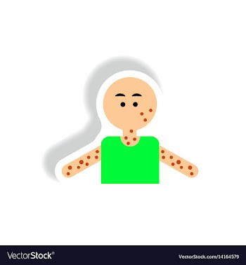 Paper sticker various symptoms of aids on vector image