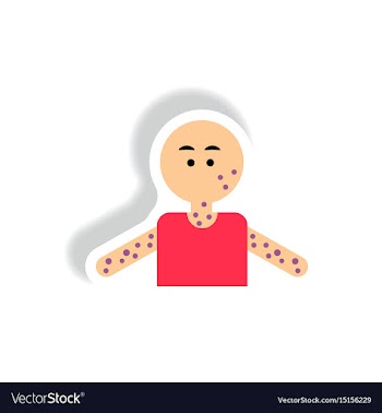 Paper sticker various symptoms of aids on vector image