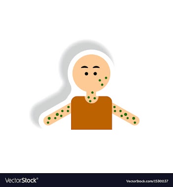 Paper sticker various symptoms of aids on vector image