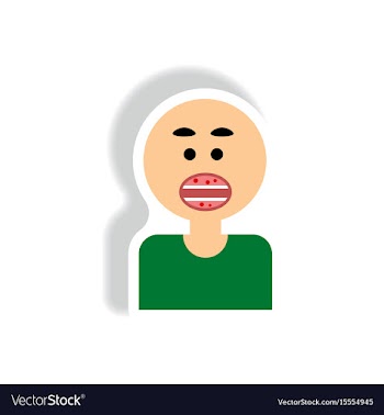 Paper sticker various symptoms of aids on vector image