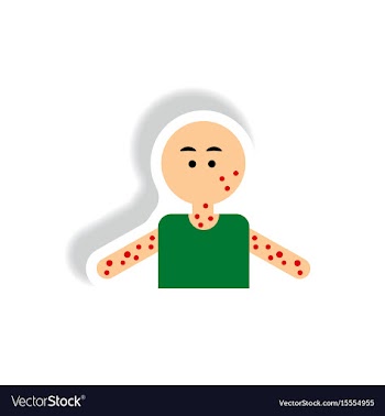 Paper sticker various symptoms of aids on vector image