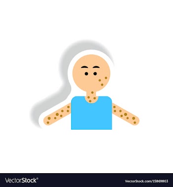 Paper sticker various symptoms of aids on vector image
