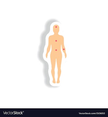 Paper sticker various symptoms of leukemia vector image