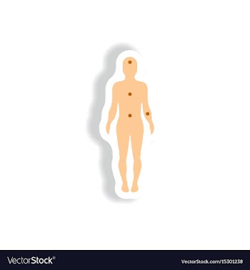 Paper sticker various symptoms of leukemia vector image