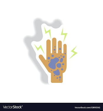 Paper sticker various symptoms of Malaria vector image