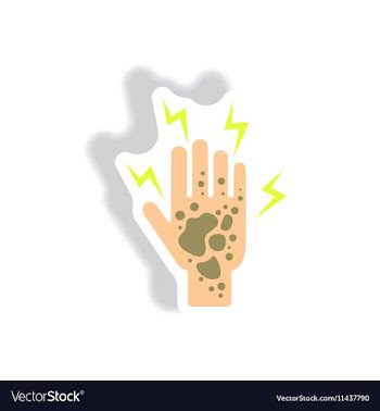 Paper sticker various symptoms of Malaria vector image