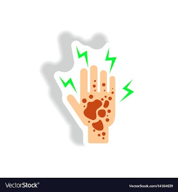 Paper sticker various symptoms of malaria vector image