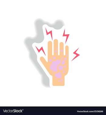 Paper sticker various symptoms of malaria vector image
