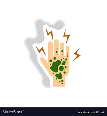Paper sticker various symptoms of malaria vector image