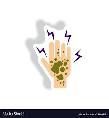 Paper sticker various symptoms of malaria vector image
