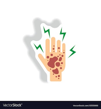 Paper sticker various symptoms of malaria vector image