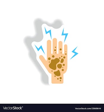 Paper sticker various symptoms of malaria vector image
