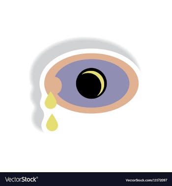 Paper sticker various symptoms of Zika on vector image