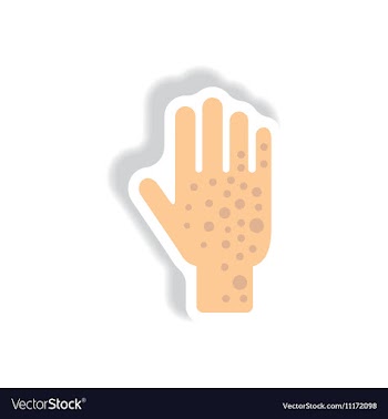 Paper sticker various symptoms of Zika on vector image