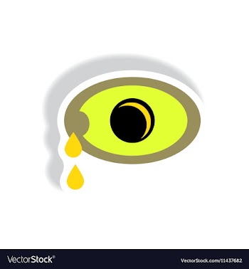 Paper sticker various symptoms of Zika on vector image